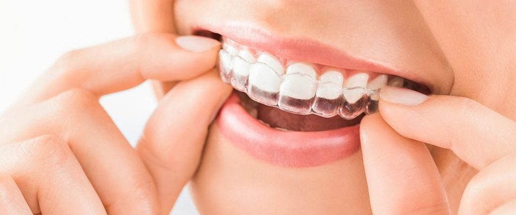 dentist Invisalign