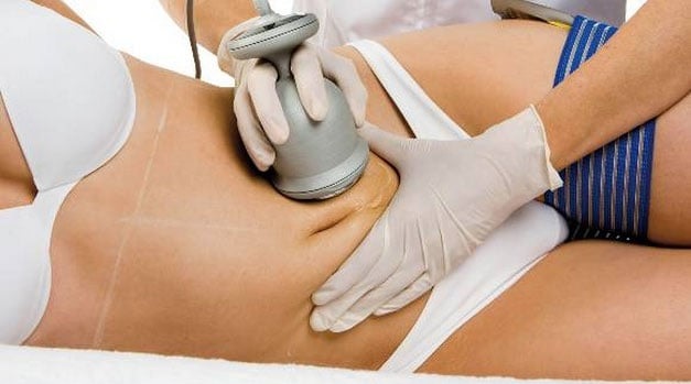 All You Need To Know About The Liposuction Procedure