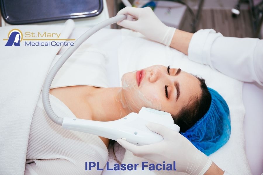 Why Should You Also Prefer Ipl Laser Facial For Better Treatment?