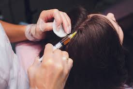 Essential Information on benefits of the hair transplant