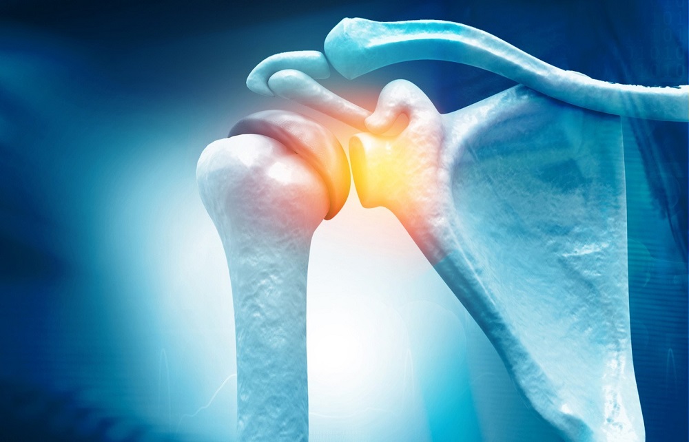 Frozen Shoulder: Symptoms, Causes, And Treatment