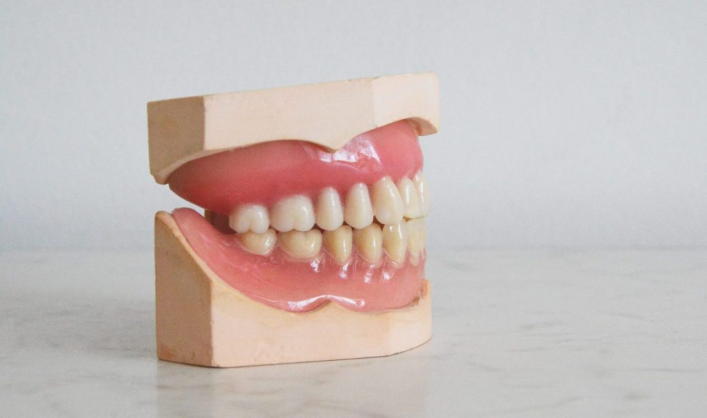 Difference Between Dental Implant Placement And Implant Restoration.