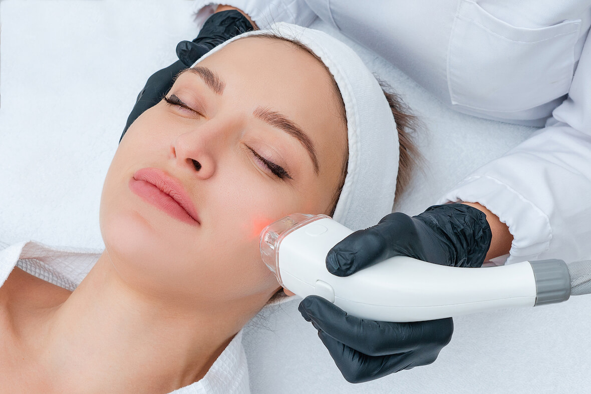 What Skin Conditions Can Pico Laser Treat?