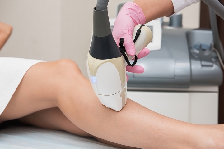 BENEFITS AND DOLES OF LASER HAIR REMOVAL
