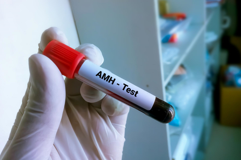 Understanding The Amh Test: What It Is, How It's Done. - Stylista Fitness