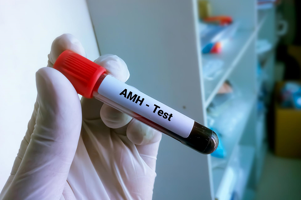 Understanding the amh test: what it is, how it’s done.