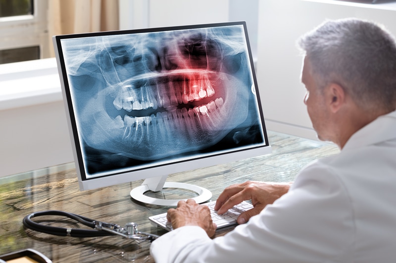 Precise Images, Safer Practices: Exploring the Benefits of Digital X-Rays