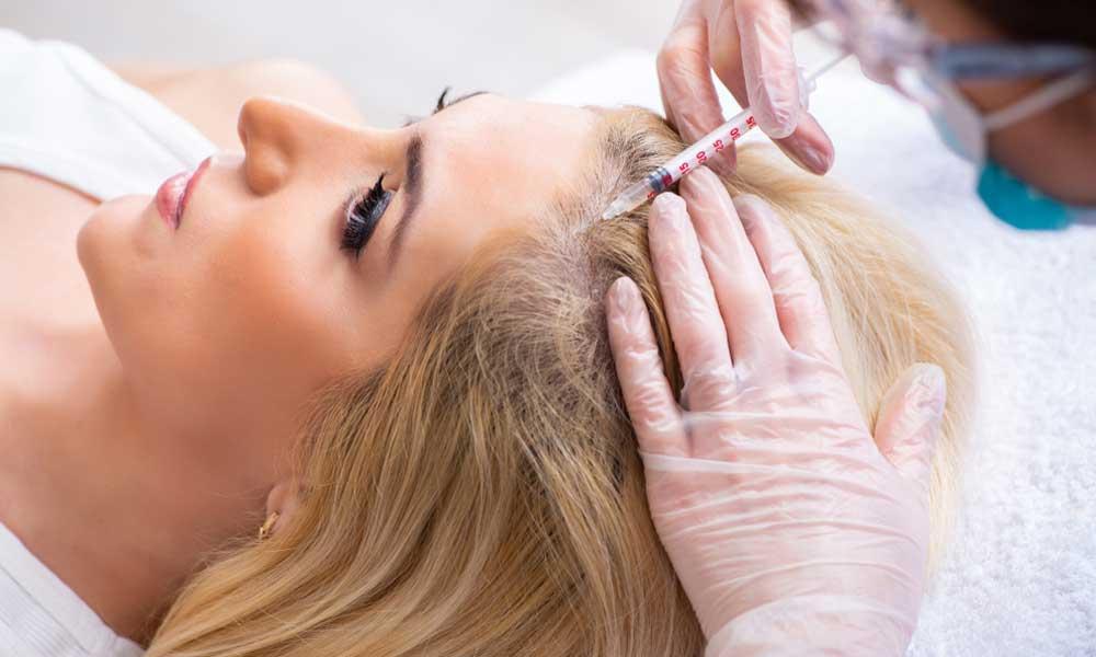 WHAT IS PRP TREATMENT FOR HAIR LOSS?